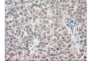 Immunohistochemistry (IHC) image for anti-Acetyl-CoA Acetyltransferase 2 (ACAT2) antibody (ABIN1496398)