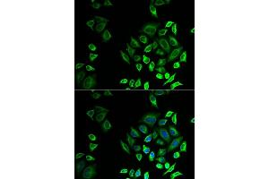 Immunofluorescence analysis of U2OS cells using PLG2D antibody (ABIN6132162, ABIN6145727, ABIN6145729 and ABIN6222983). (PLA2G2D anticorps  (AA 21-145))