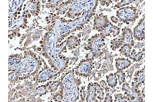IHC analysis of Glutathione Reductase using anti-Glutathione Reductase antibody (ABIN5693151). (Glutathione Reductase anticorps  (AA 256-522))