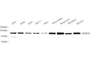 Western blot analysis of MTHFD1 (ABIN7074609) at dilution of 1: 1000 (MTHFD1 anticorps)
