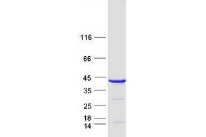Validation with Western Blot