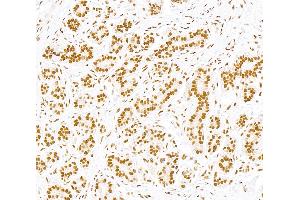 Immunohistochemistry (IHC) image for anti-Sp1 Transcription Factor (SP1) (AA 250-300) antibody (ABIN7795788)