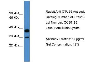 WB Suggested Anti-OTUB2  Antibody Titration: 0. (OTUB2 anticorps  (Middle Region))