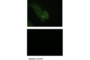 NMuFG cells in ImmunohistochemistryDilutions 1:50 for the three primary antibodies and 1:100 for FITC-conjugated secondary.