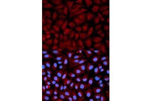 Immunofluorescence analysis of U2OS cells using SERPINC1 antibody. (SERPINC1 anticorps  (AA 33-185))