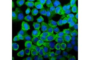 IF analysis of YB1 using anti-YB1 antibody (ABIN3043966). (YBX1 anticorps  (C-Term))