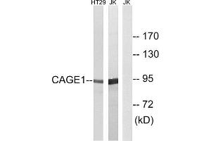 Western Blotting (WB) image for anti-Cancer Antigen 1 (CAGE1) (C-Term) antibody (ABIN1850982) (CAGE1 anticorps  (C-Term))