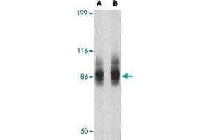 Western blot analysis of SP110 in SW480 cell lysate with SP110 polyclonal antibody  at (A) 1 and (B) 2 ug/mL . (SP110 anticorps  (N-Term))
