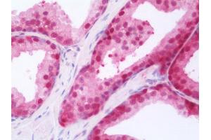 Anti-RARG / RAR-Gamma antibody IHC staining of human prostate. (Retinoic Acid Receptor gamma anticorps  (AA 1-245))