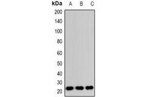 Western blot analysis of RAB24 expression in HeLa (A), RAW264. (RAB24 anticorps)
