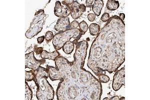 Immunohistochemical staining of human placenta with RILPL2 polyclonal antibody  shows strong cytoplasmic positivity in trophoblastic cells at 1:200-1:500 dilution.