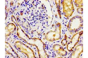 Immunohistochemistry of paraffin-embedded human kidney tissue using ABIN7145059 at dilution of 1:100 (NPR3 anticorps  (AA 36-127))