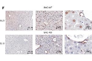 Expression changes of Hedgehog signaling components.