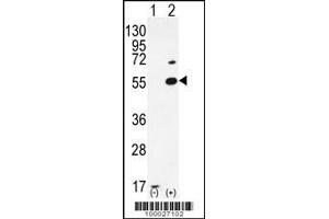 Western blot analysis of PRMT2 using rabbit polyclonal PRMT2 Antibody (A37) using 293 cell lysates (2 ug/lane) either nontransfected (Lane 1) or transiently transfected (Lane 2) with the PRMT2 gene. (PRMT2 anticorps  (N-Term))