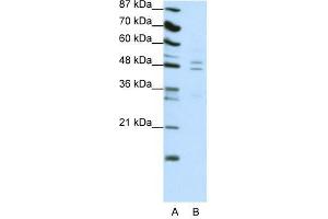 Western Blot showing TANK antibody used at a concentration of 1-2 ug/ml to detect its target protein.