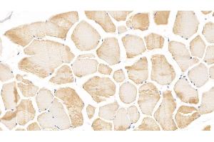 Detection of cTnI in Human Skeletal muscle Tissue using Monoclonal Antibody to Cardiac Troponin I (cTnI) (TNNI3 anticorps  (AA 1-203))