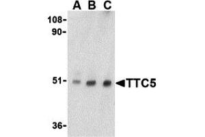 Western Blotting (WB) image for anti-Tetratricopeptide Repeat Domain 5 (TTC5) (C-Term) antibody (ABIN1030785) (TTC5 anticorps  (C-Term))