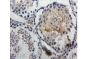 Used in DAB staining on fromalin fixed paraffin-embedded Testis tissue (Ghrelin anticorps  (AA 28-117))