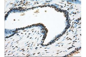Immunohistochemical staining of paraffin-embedded Kidney tissue using anti-ACSBG1 mouse monoclonal antibody. (ACSBG1 anticorps)