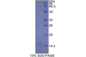 SDS-PAGE analysis of Mouse NAGase Protein. (MGEA5 Protéine)