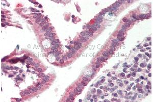 Rabbit Anti-SMAD4 antibody  Formalin Fixed Paraffin Embedded Tissue: Human Adult Small intestine  Observed Staining: Cytoplasm in hepatocytes Primary Antibody Concentration: 1:600 Secondary Antibody: Donkey anti-Rabbit-Cy3 Secondary Antibody Concentration: 1:200 Magnification: 20X Exposure Time: 0.