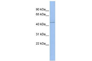 WB Suggested Anti-PML Antibody Titration:  0. (PML anticorps  (N-Term))