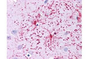 GLUD1 antibody was used for immunohistochemistry at a concentration of 4-8 ug/ml.