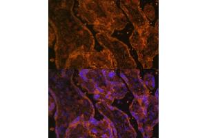 Immunofluorescence analysis of human placenta using CD34 antibody (ABIN6134661, ABIN6138169, ABIN6138171 and ABIN6218103) at dilution of 1:100.