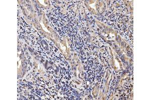 IHC analysis of EXOSC8 using anti-EXOSC8 antibody (ABIN7601850). (EXOSC8 anticorps  (AA 49-216))