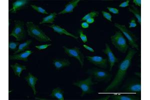 Immunofluorescence of monoclonal antibody to TRIP6 on HeLa cell. (TRIP6 anticorps  (AA 1-100))