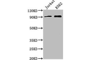 Western Blot Positive WB detected in: Jurkat whole cell lysate, K562 whole cell lysate All lanes: MARK2 antibody at 1:2000 Secondary Goat polyclonal to rabbit IgG at 1/50000 dilution Predicted band size: 88, 79, 84, 82, 81, 78, 87, 83, 80 kDa Observed band size: 88 kDa