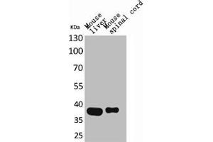 Western Blot analysis of mouse liver mouse spinal cord cells using Aldolase C Polyclonal Antibody (ALDOC anticorps  (N-Term))