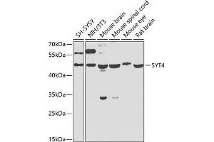 Western blot analysis of extracts of various cell lines, using SYT4 antibody (ABIN6129135, ABIN6148791, ABIN6148792 and ABIN6223676) at 1:1000 dilution. (SYT4 anticorps  (AA 38-190))