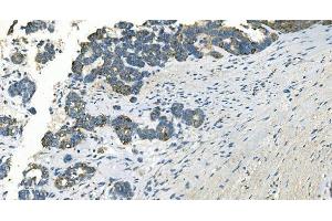 IHC analysis of IDH2 using anti-IDH2 antibody (ABIN7602786). (IDH2 anticorps  (C-Term))