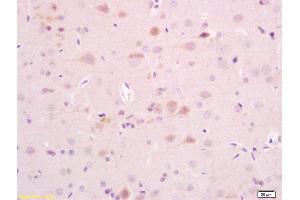 Formalin-fixed and paraffin rat brain tissue labeled with Anti-AKAP5 Polyclonal Antibody, Unconjugated (ABIN1387544) at 1:200, followed by conjugation to the secondary antibody and DAB staining
