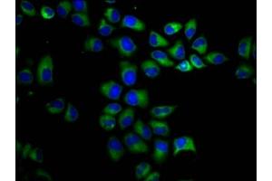 Immunofluorescence staining of Hela cells with ABIN7163832 at 1:200, counter-stained with DAPI. (PKD1 anticorps  (AA 615-753))