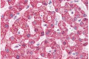 Human Liver (formalin-fixed, paraffin-embedded) stained with IFIH1 antibody ABIN337077 at 5 ug/ml followed by biotinylated goat anti-rabbit IgG secondary antibody ABIN481713, alkaline phosphatase-streptavidin and chromogen. (IFIH1 anticorps  (Internal Region))