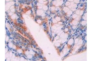 Detection of IAP in Mouse Colon Tissue using Polyclonal Antibody to Integrin Associated Protein (IAP)