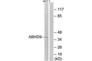 Western blot analysis of extracts from MCF-7 cells, using ABHD9 Antibody. (ABHD9 anticorps  (AA 101-150))