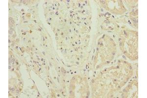 Immunohistochemistry of paraffin-embedded human kidney tissue using ABIN7176421 at dilution of 1:100 (ZNF596 anticorps  (AA 201-504))