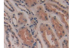 Detection of COX 2 in Human Kidney Tissue using Polyclonal Antibody to Cyclooxygenase-2 (COX 2)