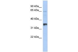 WB Suggested Anti-UBAC2 Antibody Titration: 0. (UBAC2 anticorps  (Middle Region))