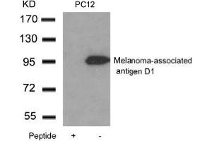Western blot analysis of extracts from PC12 cells using Melanoma-associated antigen D1and the same antibody preincubated with blocking peptide. (MAGED1 anticorps  (C-Term))