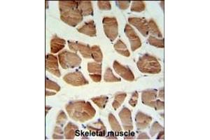 ATP2A1 Antibody (C-term) (ABIN1881089 and ABIN2840069) IHC analysis in formalin fixed and paraffin embedded human skeletal muscle followed by peroxidase conjugation of the secondary antibody and DAB staining.