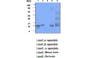 The recombinant human synuclein family (alpha-,beta- and gamma-) (each 20ng), Mouse brain and Rat brain (30 ug) were resolved by SDS-PAGE, transferred to PVDF membrane and probed with anti-human alpha,beta-synuclein (1:1000). (alpha (AA 119-140) anticorps)