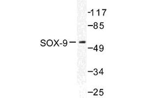 Image no. 1 for anti-SRY (Sex Determining Region Y)-Box 9 (SOX9) antibody (ABIN272082) (SOX9 anticorps)