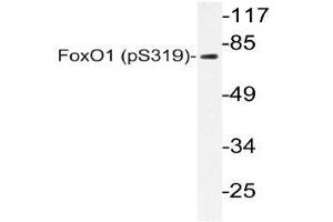 Western blot (WB) analyzes of p-FoxO1 antibody in extracts from 293 SERUM cells. (FOXO1 anticorps  (pSer319))
