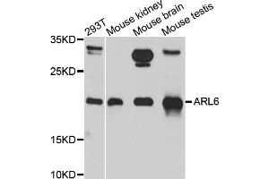 Western blot analysis of extracts of various cell lines, using ARL6 antibody. (ARL6 anticorps)