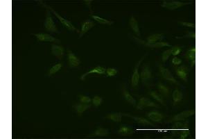 Immunofluorescence of monoclonal antibody to ASB3 on HeLa cell. (ASB3 anticorps  (AA 1-518))