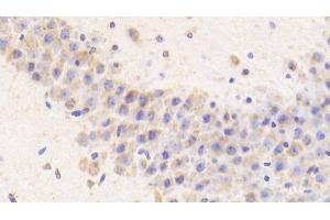 Detection of CTSD in Mouse Cerebellum Tissue using Polyclonal Antibody to Cathepsin D (CTSD) (Cathepsin D anticorps  (AA 66-410))